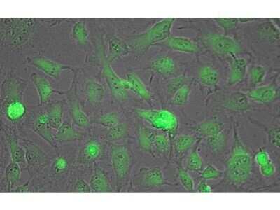 Immunocytochemistry/Immunofluorescence: Lactate Dehydrogenase Antibody [HRP] [NB600-863] - Tissue: HeLa cells. Fixation: fixed for 5 min in 1:1 MeTOH:Acetone, blocked (preservative free) for 15 min. Antigen retrieval: not required. Primary antibody: Lactate Dehydrogenase antibody at 1:200 for 1 h at RT. Secondary antibody: DyLight 488 conjugated Streptavidin antibody at 1:10,000 for 30 min at RT. Staining: Lactate Dehydrogenase as green fluorescent signal.